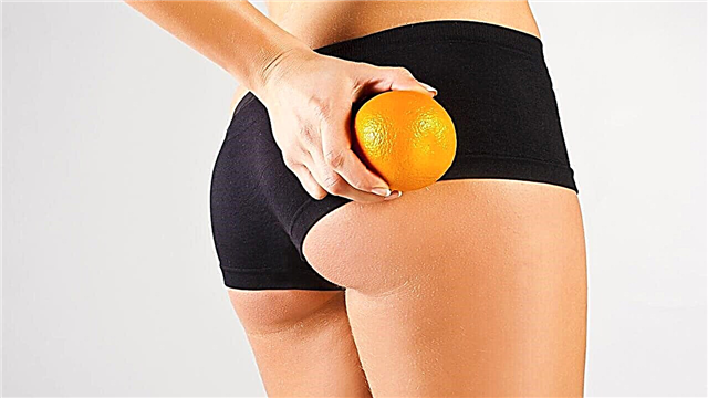 How to get rid of cellulite at home: 12 effective remedies