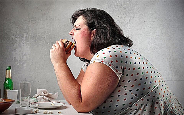 5 größten Mythen über Fettleibigkeit