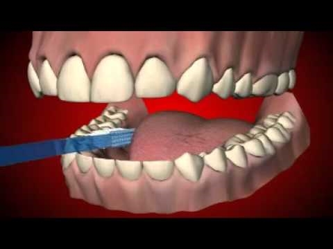 10 geriausių dantų valymo klaidų